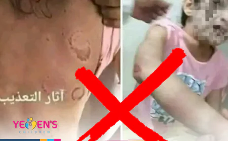 الصورة من  مصر وليست لتعذيب طفلة من قبل زوج ابيها في صنعاء
