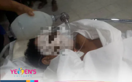 مسلحون يقتحمون مدرسة في تعز وإصابة طفل بطلق ناري