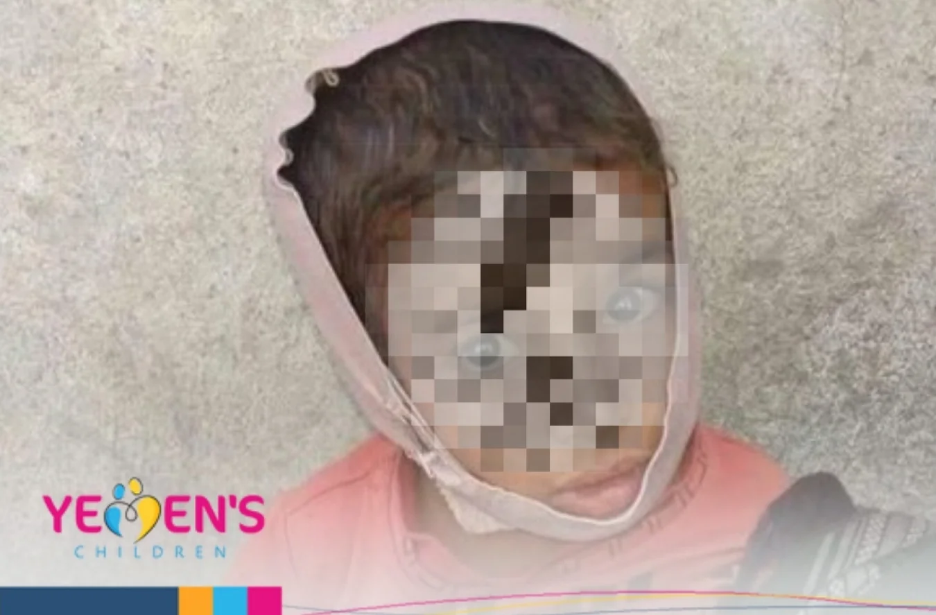 تعز: إصابة طفل بجروح متفاوتة جراء قصف حوثي تعز