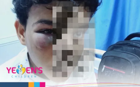 حضرموت – اعتداء على طفل في المكلا يثير غضبًا واسعًا