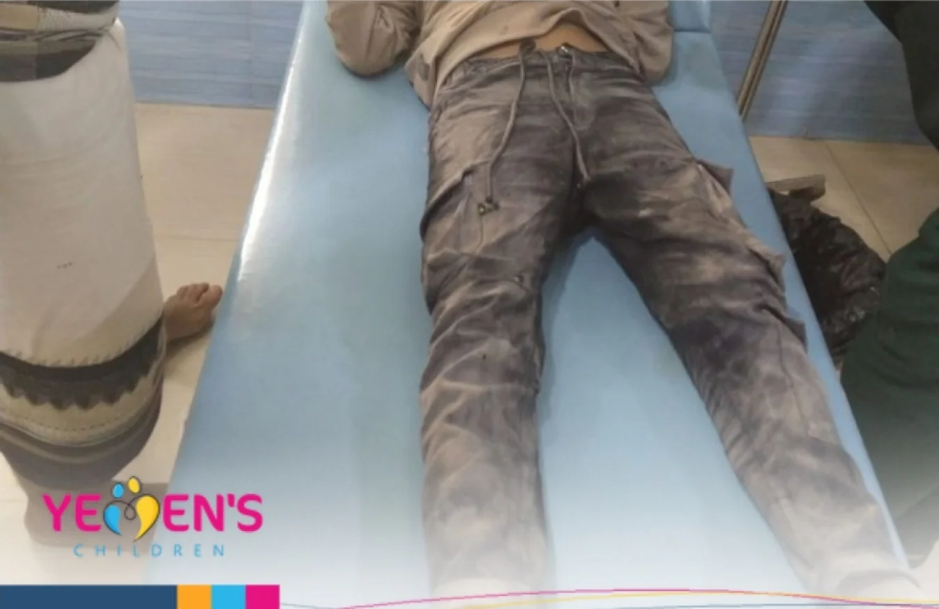 إصابة طفلين جراء قصف مدفعي شرقي محافظة تعز