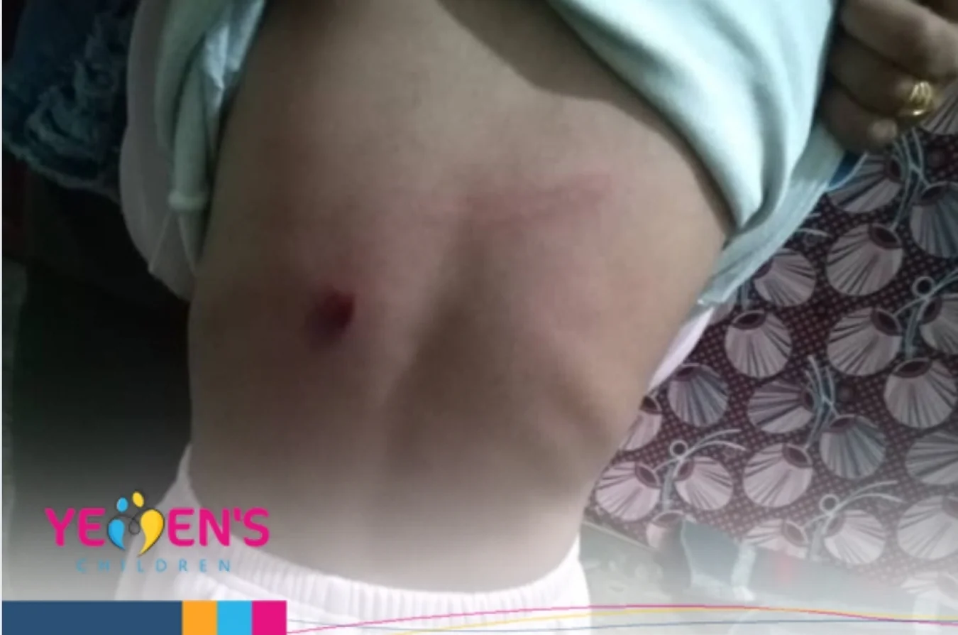 اعتداء أسري عنيف في الضالع في انتهاك لقانون حقوق الطفل