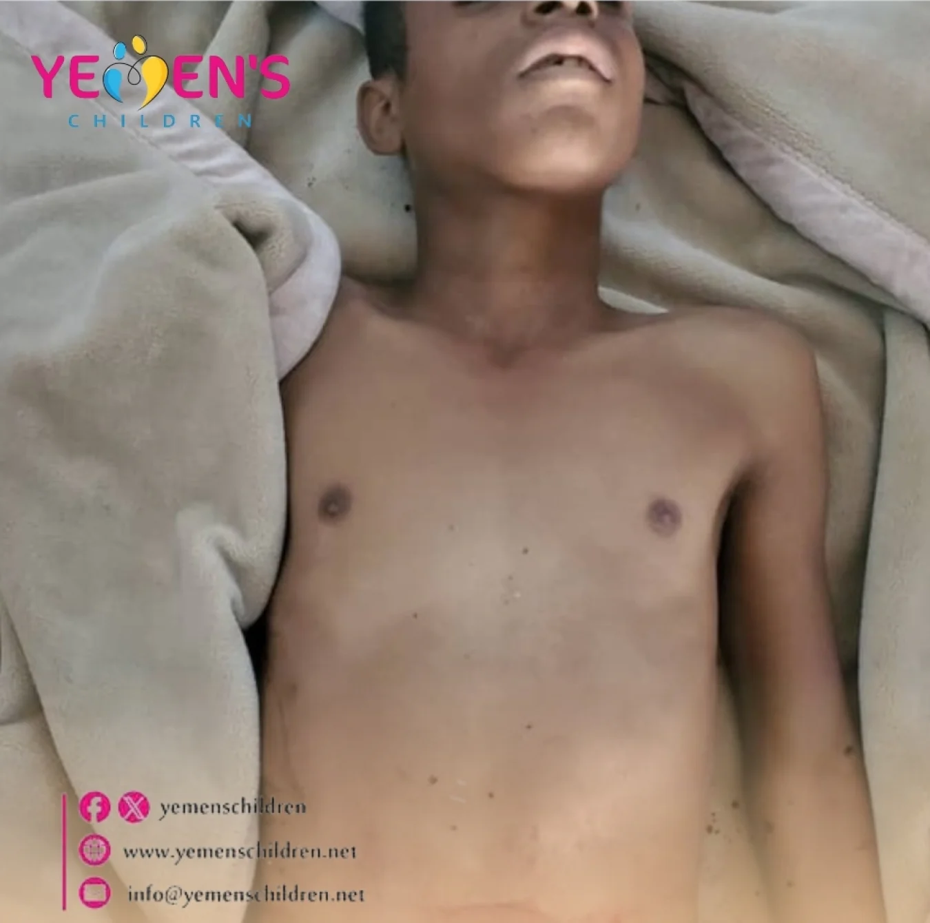 مقتل طفل في مدينة إب، إثر خلافات أسرية