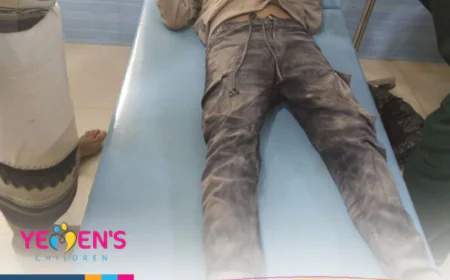 إصابة طفلين جراء قصف مدفعي شرقي محافظة تعز