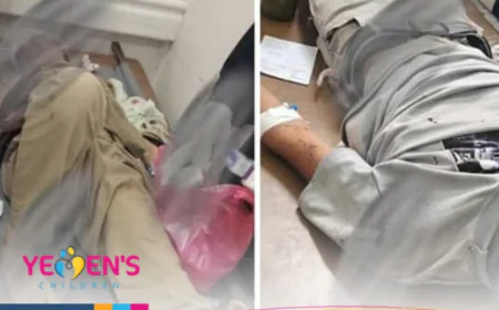 Four Children Killed and Injured in a Roadside Bomb Explosion in Taiz