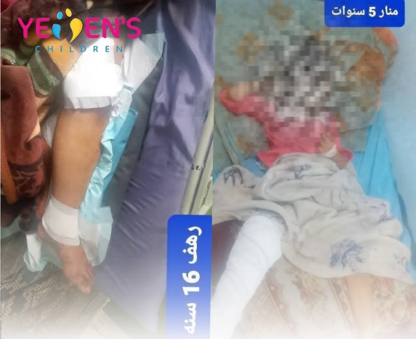 إصابة طفلتين جراء إطلاق نار في محافظة إب