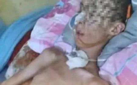 Child in Critical Condition After Accident in Al-Dhalea