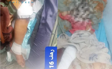 إصابة طفلتين جراء إطلاق نار في محافظة إب