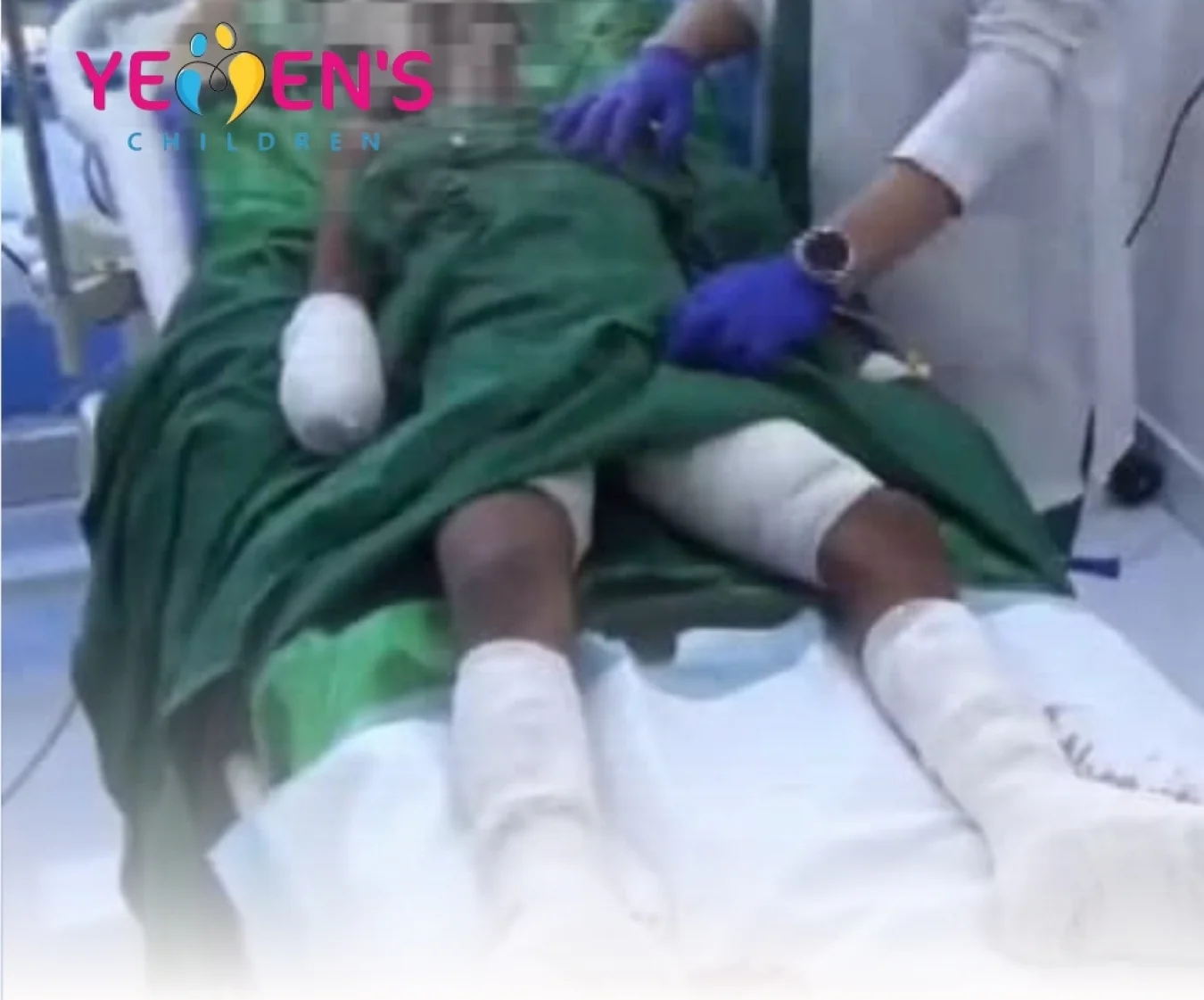 مقتل طفل  وآخر يصاب بلغم أرضي في تعز