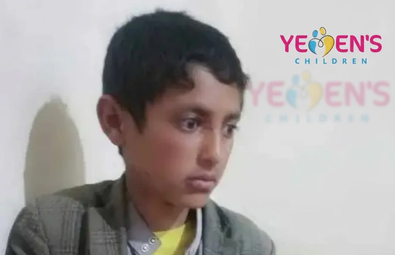 مشرف حوثي يختطف طفلًا ويودعه السجن بمحافظة عمران