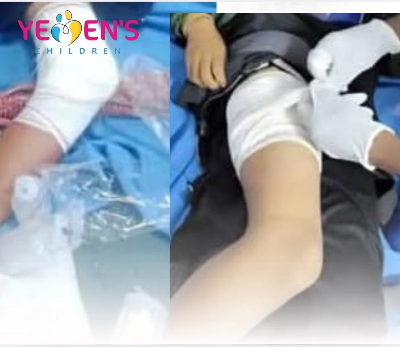 Investigation Committee Formed Following Ataq Clashes… Two Children Among the Injured