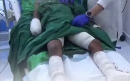 مقتل طفل  وآخر يصاب بلغم أرضي في تعز