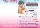 Four Children Die in Marib and Hundreds Infected as Measles Cases Surge Alarmingly in Yemen
