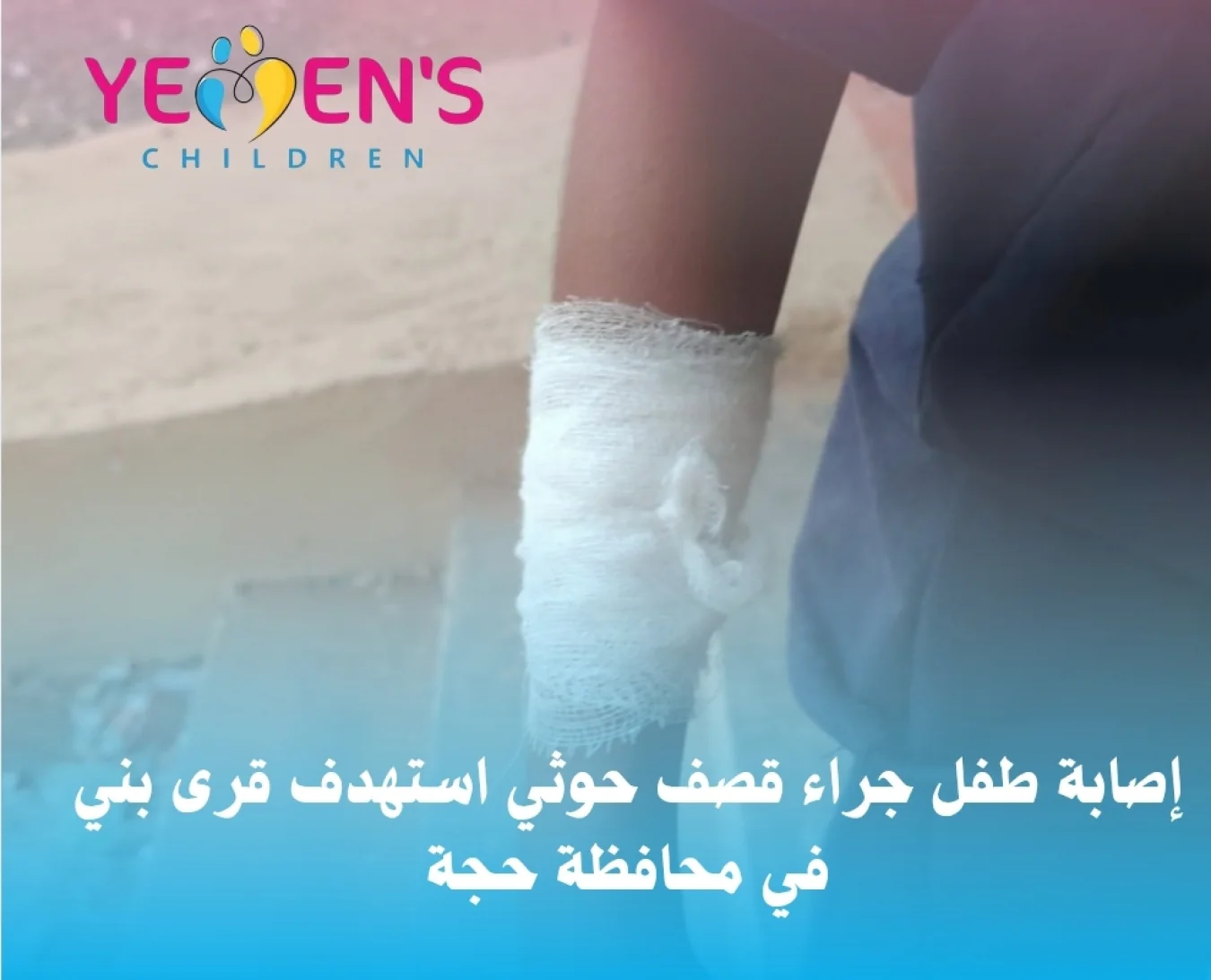 إصابة طفل جراء قصف حوثي استهدف قرى بني في محافظة حجة