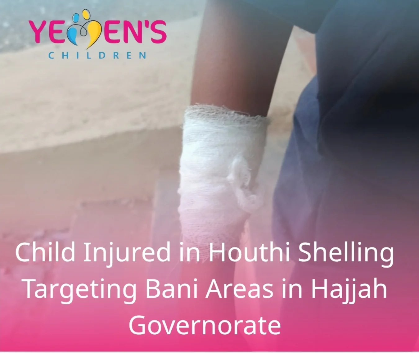 Child Injured in Houthi Shelling Targeting Bani Areas in Hajjah Governorate