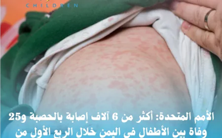 الأمم المتحدة: أكثر من 6 آلاف إصابة بالحصبة و25 وفاة بين الأطفال في اليمن خلال الربع الأول من 2026