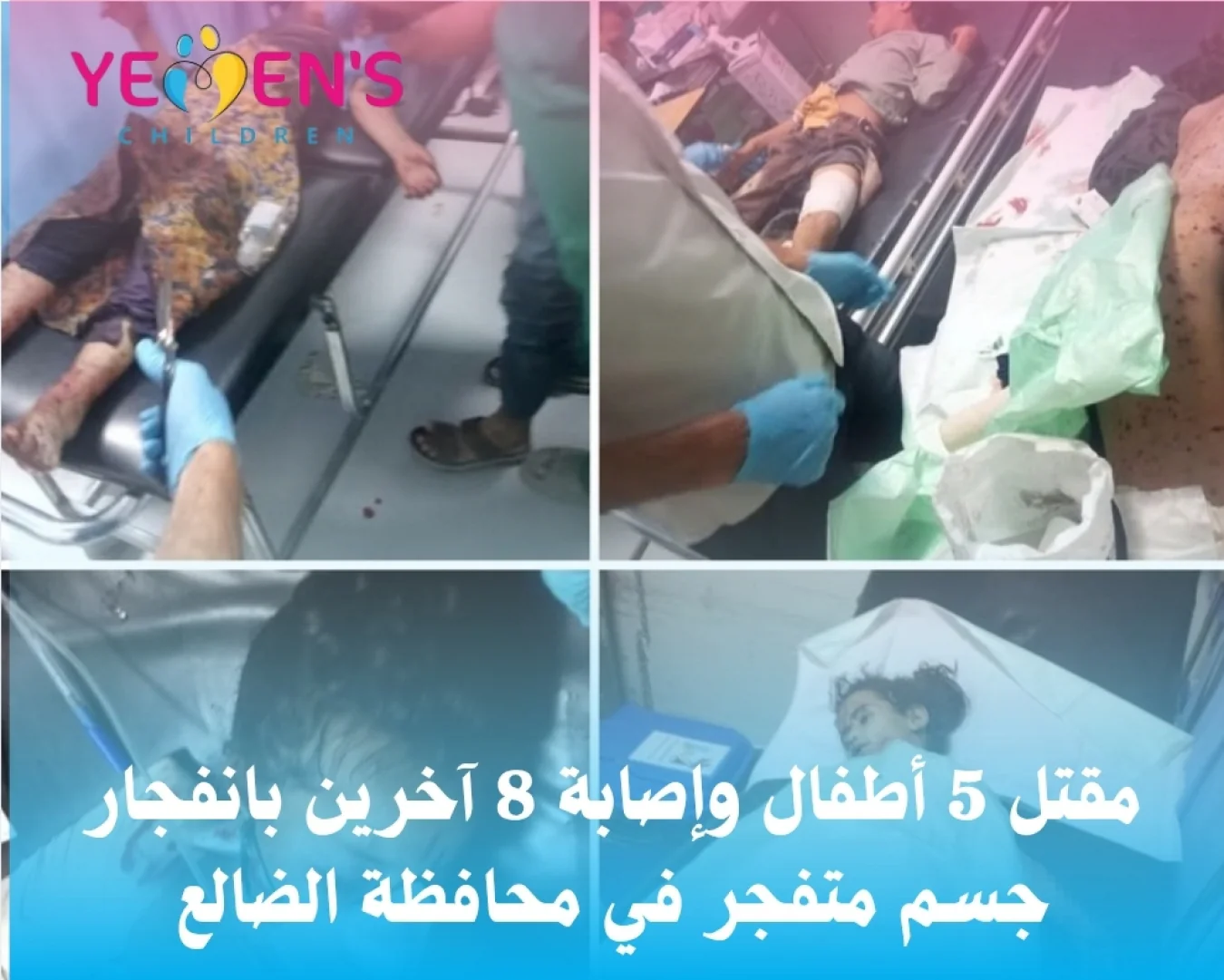 مقتل 5 أطفال وإصابة 8 آخرين بانفجار جسم متفجر في الضالع