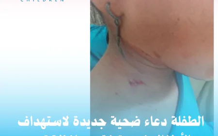 الطفلة دعاء ضحية جديدة لاستهداف الأطفال في مقبنة بمحافظة تعز