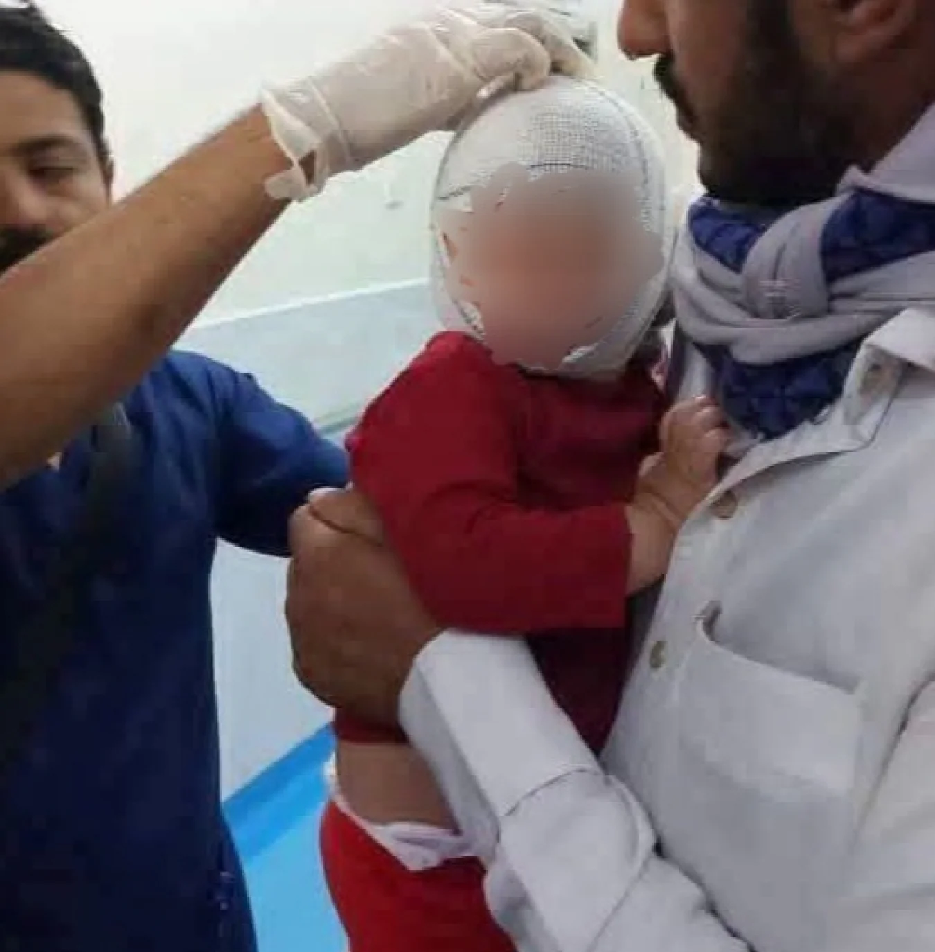 One-Year-Old Girl Among Those Injured in Shelling of Displacement Camp in Marib
