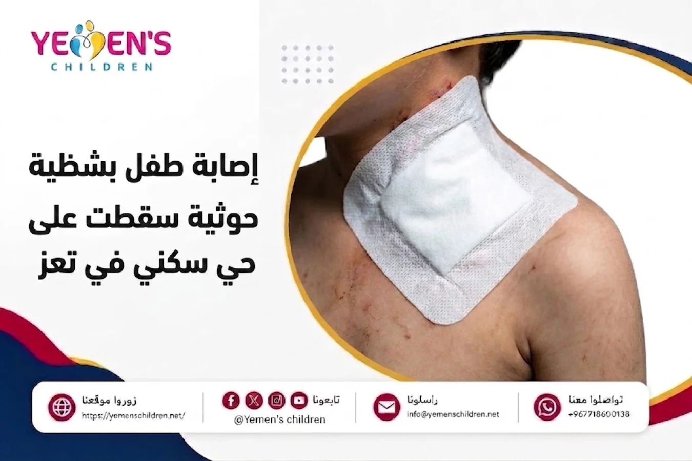 إصابة طفل بشظية إثر قذيفة حوثية سقطت على حي سكني في تعز