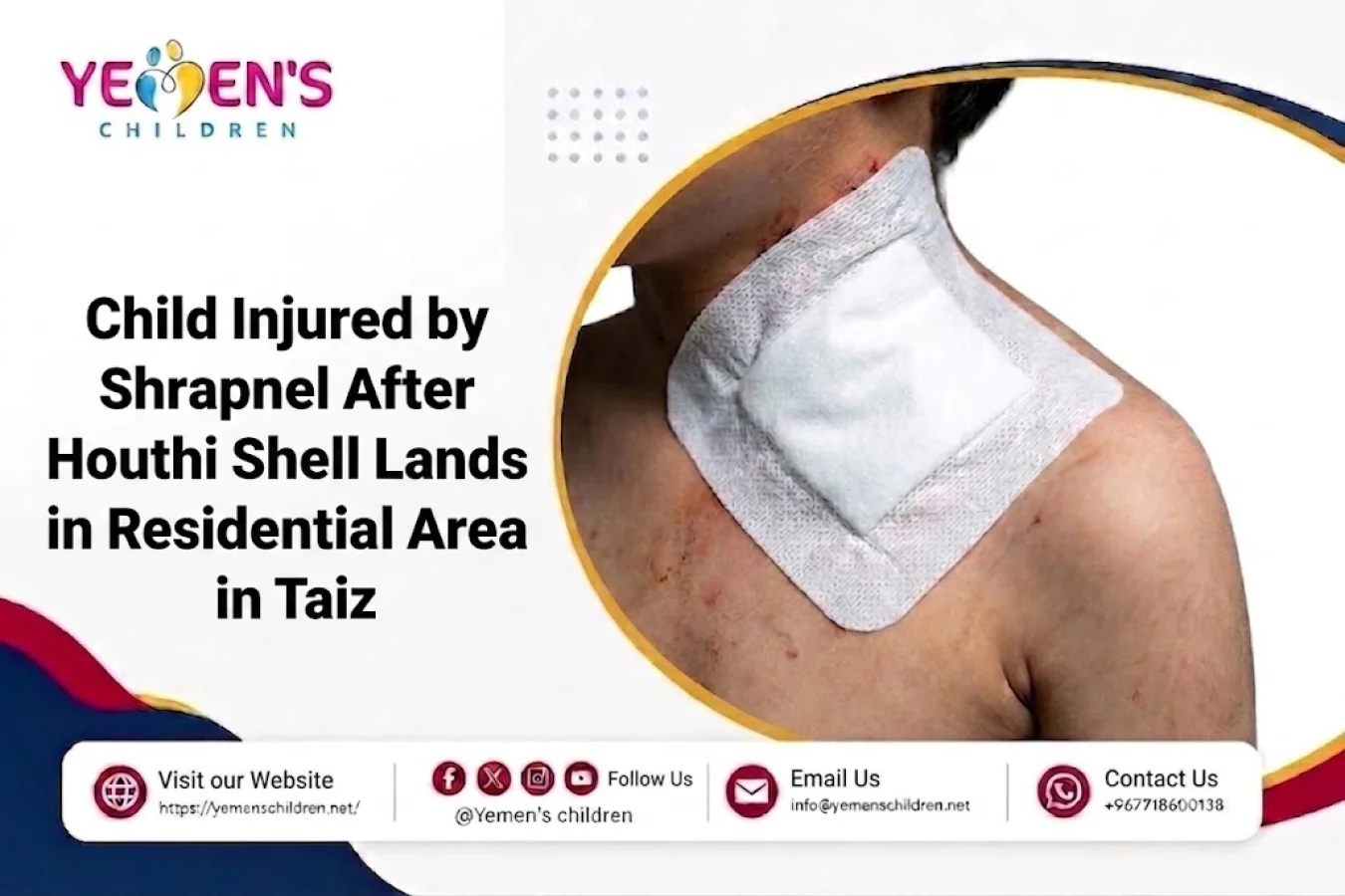 Child Injured by Shrapnel After Houthi Shell Lands in Residential Area in Taiz