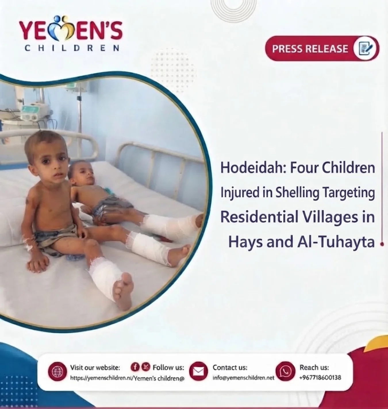 Hodeidah: Four Children Injured in Houthi Shelling Targeting Residential Villages in Hays and Al-Tuhayta