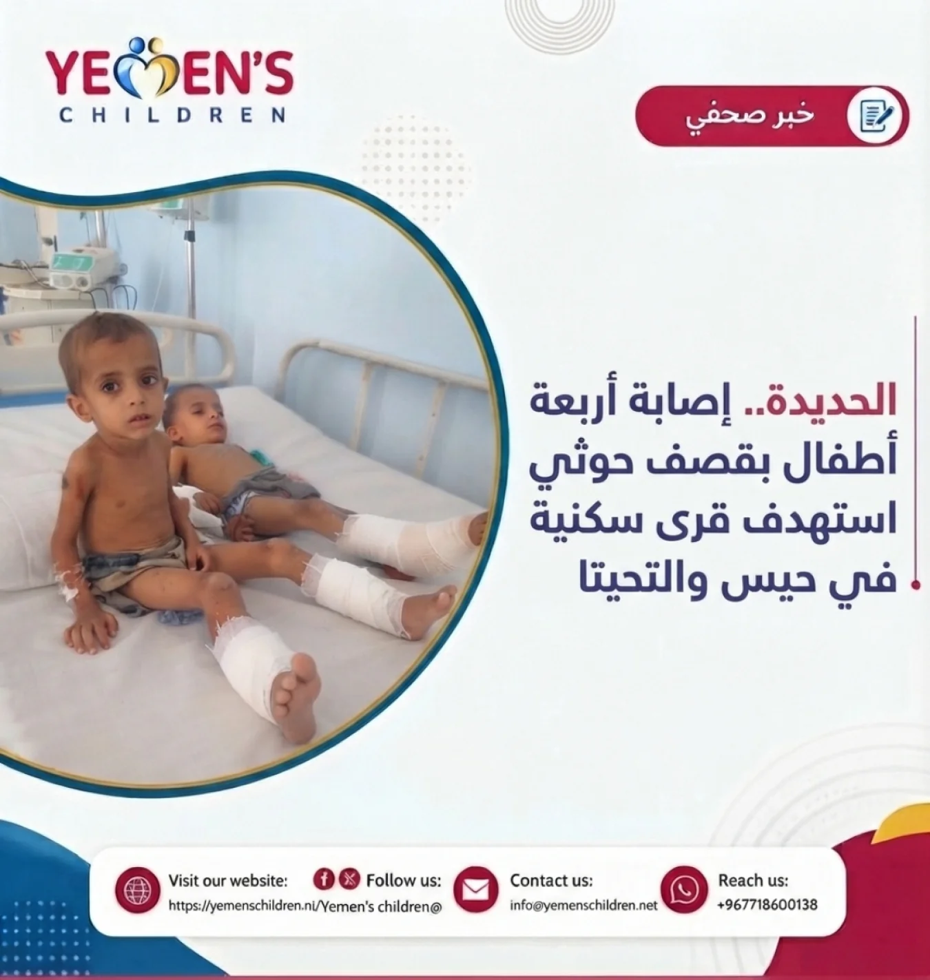 الحديدة.. إصابة أربعة أطفال بقصف حوثي استهدف قرى سكنية في حيس والتحيتا