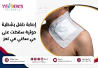 إصابة طفل بشظية إثر قذيفة حوثية سقطت على حي سكني في تعز
