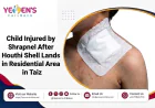 Child Injured by Shrapnel After Houthi Shell Lands in Residential Area in Taiz