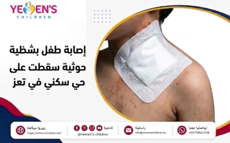 إصابة طفل بشظية إثر قذيفة حوثية سقطت على حي سكني في تعز