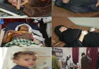 إصابة 4 أطفال بقصف حوثي في حجة وتعز، ومقتل طفلة ووالدتها دهسًا في لحج